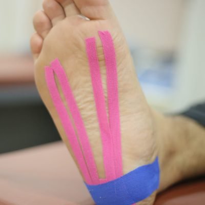 KINESIO-TAPPING-FOOT-scaled